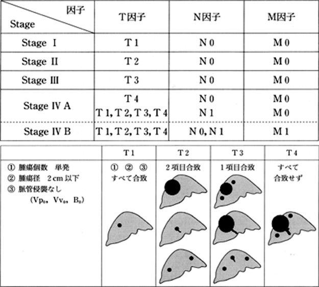2017年度　肝がん　表1